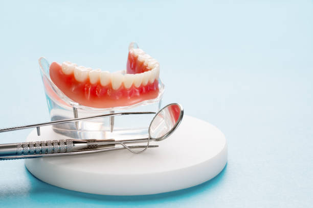 Full Mouth Reconstruction in New Smyrna Beach, FL